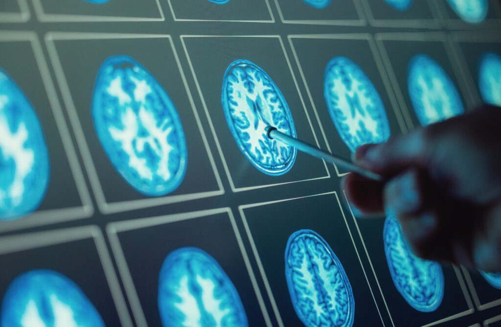 Smart Injection Shrinks Head and Neck Cancer Tumours Within Six Weeks, Trial Shows