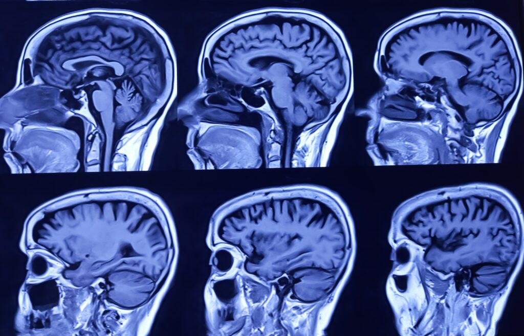 Human Brain Has Five Key ‘Eras’, With Adult Phase Starting in Early 30s, Scientists Find